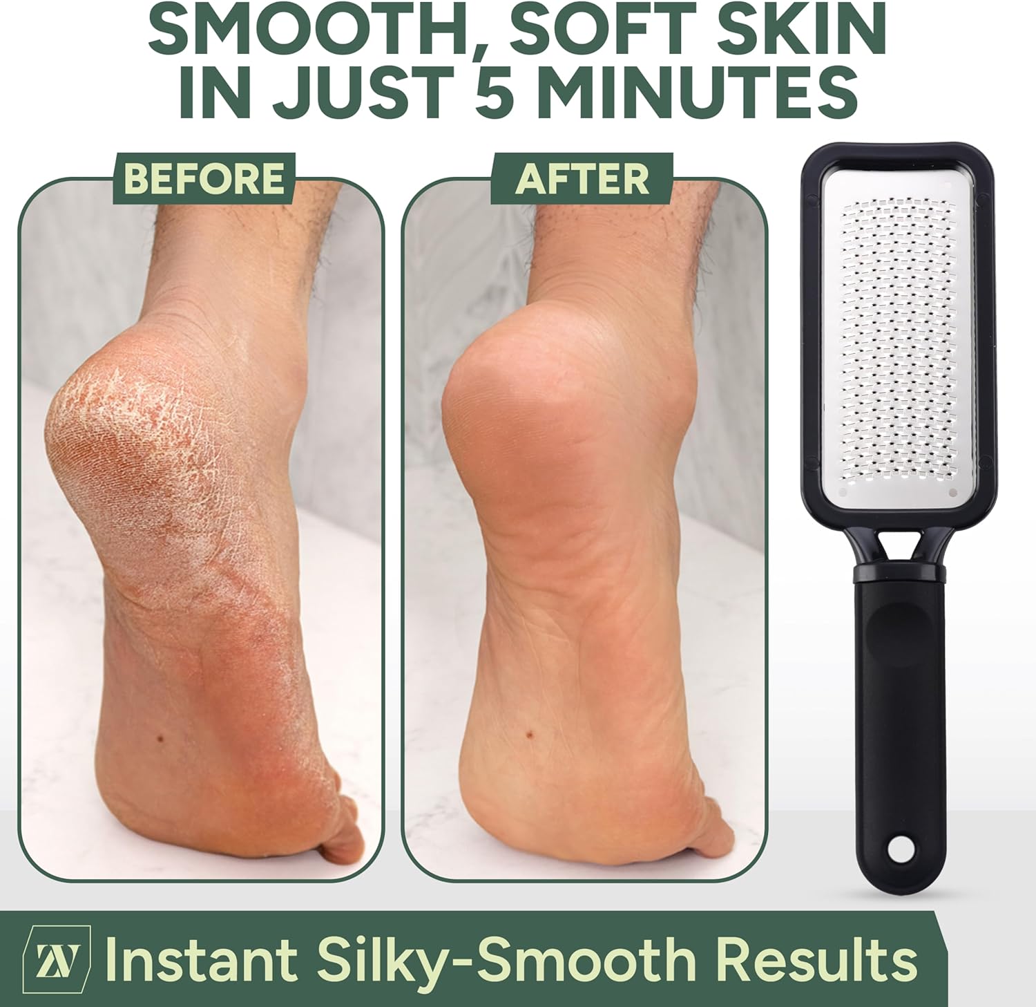 Zuvo Foot File for Hard Skin - Surgical Stainless Steel Callus Remover (XL) with Skin Catcher | Wet & Dry Pedicure Foot Scraper for Cracked Heels & Dead Skin Removal